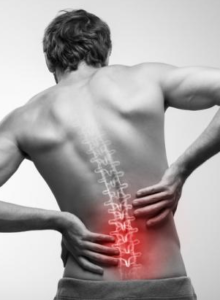 Rückenschmerzen unterer Rücken